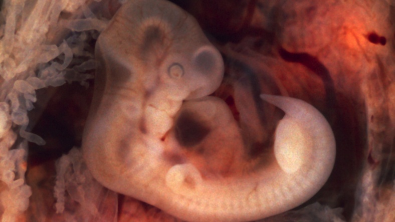 embryo