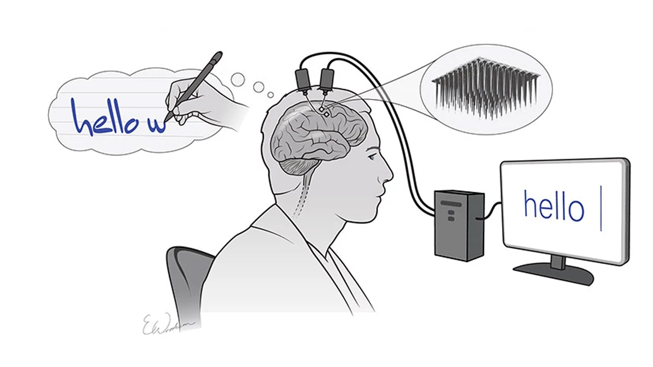 Felçli Bir Birey, Düşünceleri Yazıya Çeviren Yapay Zeka Sistemiyle Hızlı Bir Şekilde Yazı Yazdı