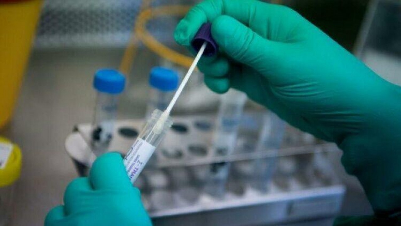 PCR Testi artyla lgili ok Sorulan 13 Soru ve Cevaplar