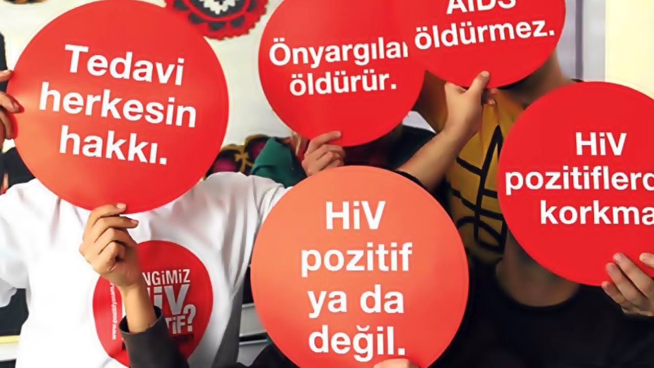 hiv aids