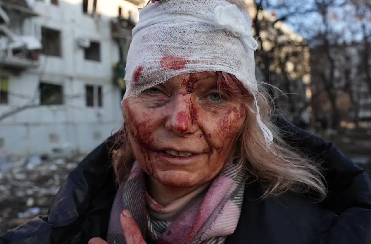 The face of war in Ukraine