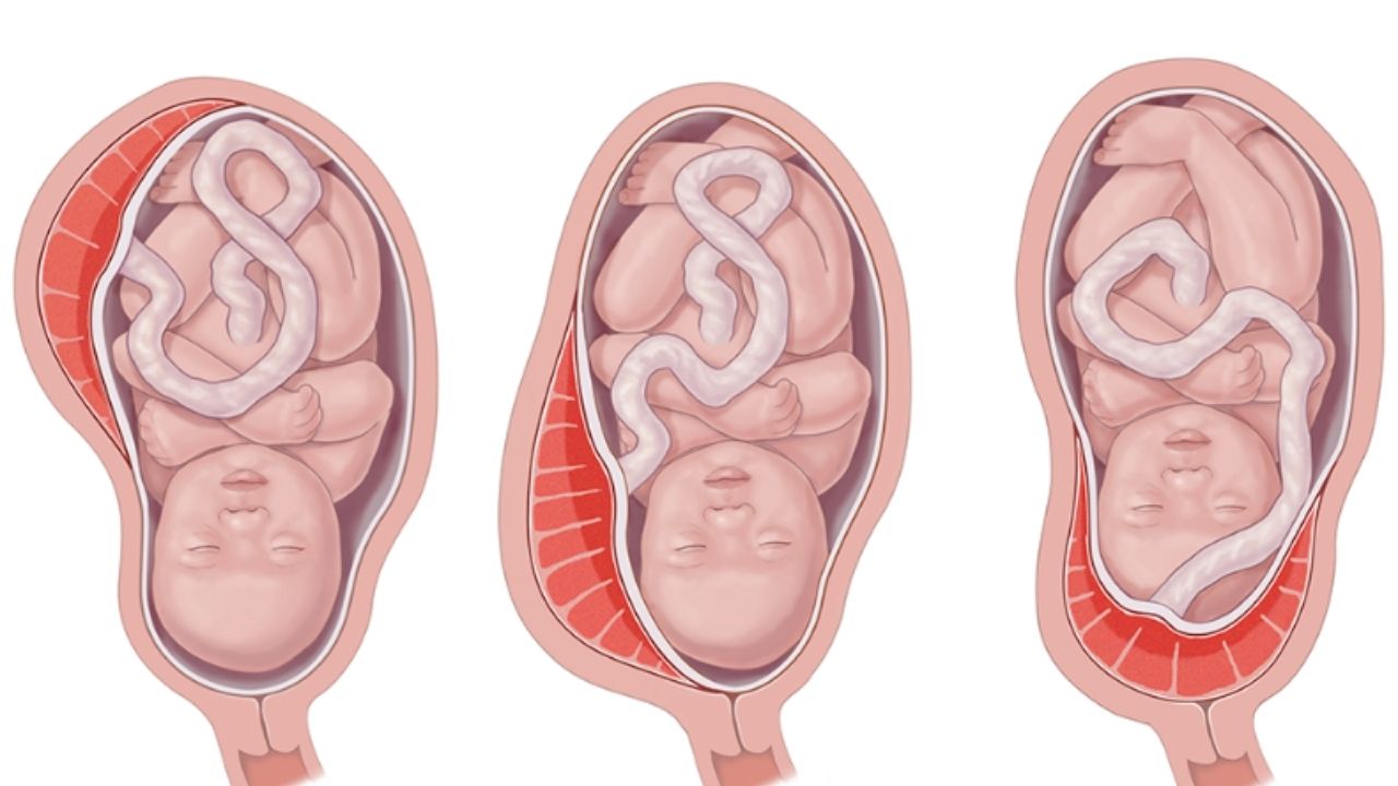 Placental Passage 