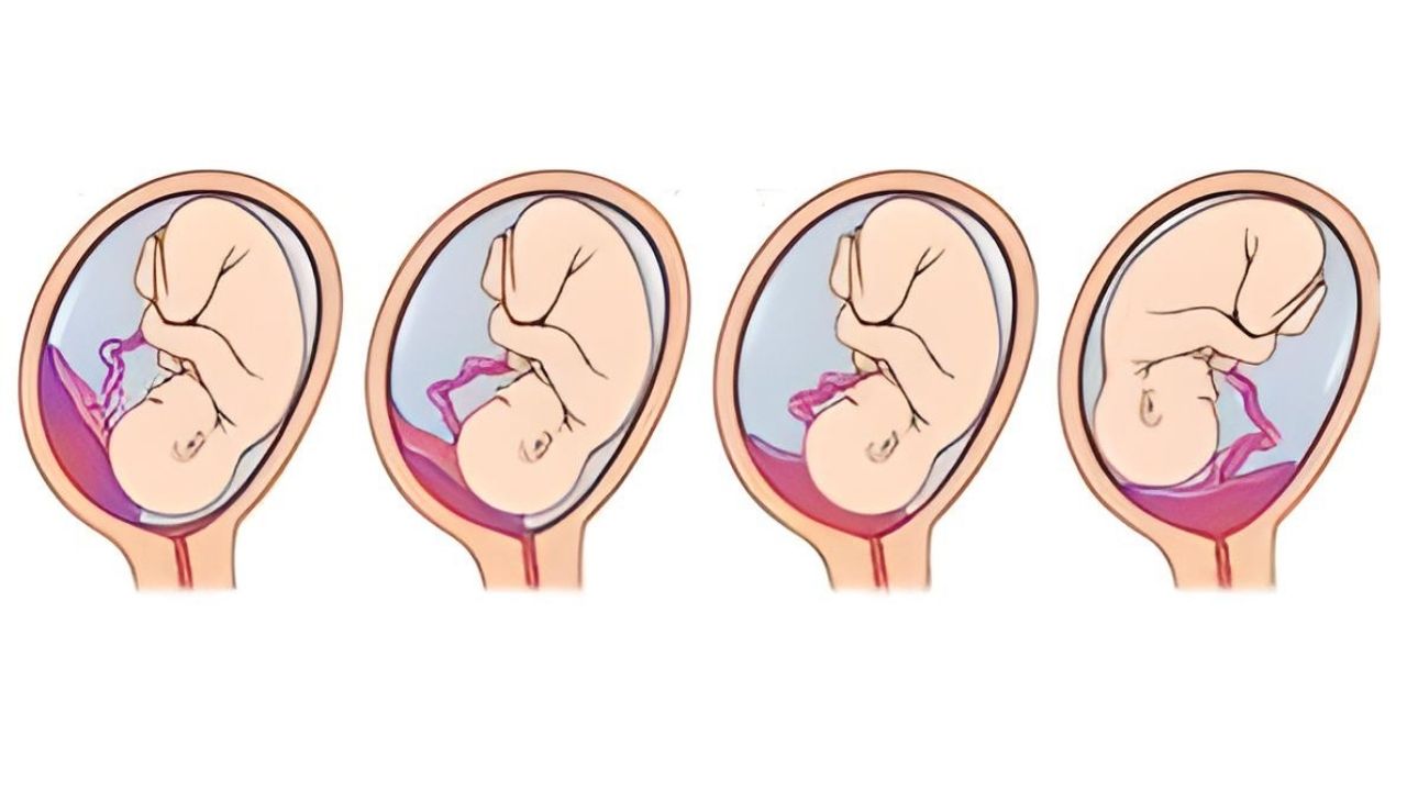 Placenta Formation