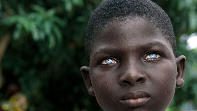Mavi Göz