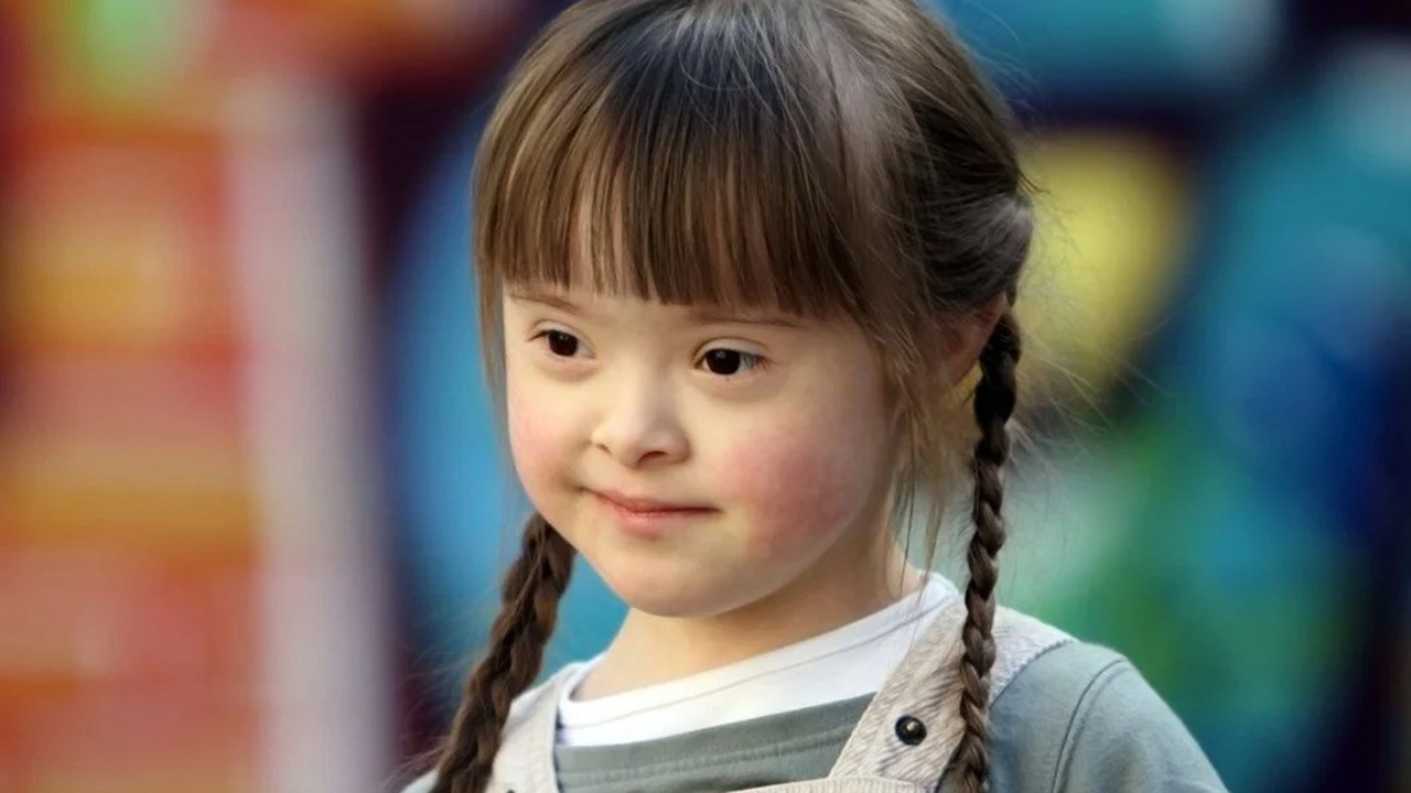 down syndrome child