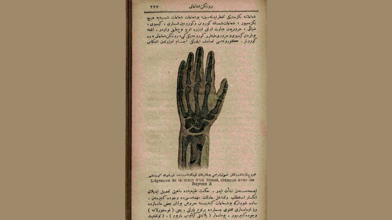 The first x-ray in the Ottoman