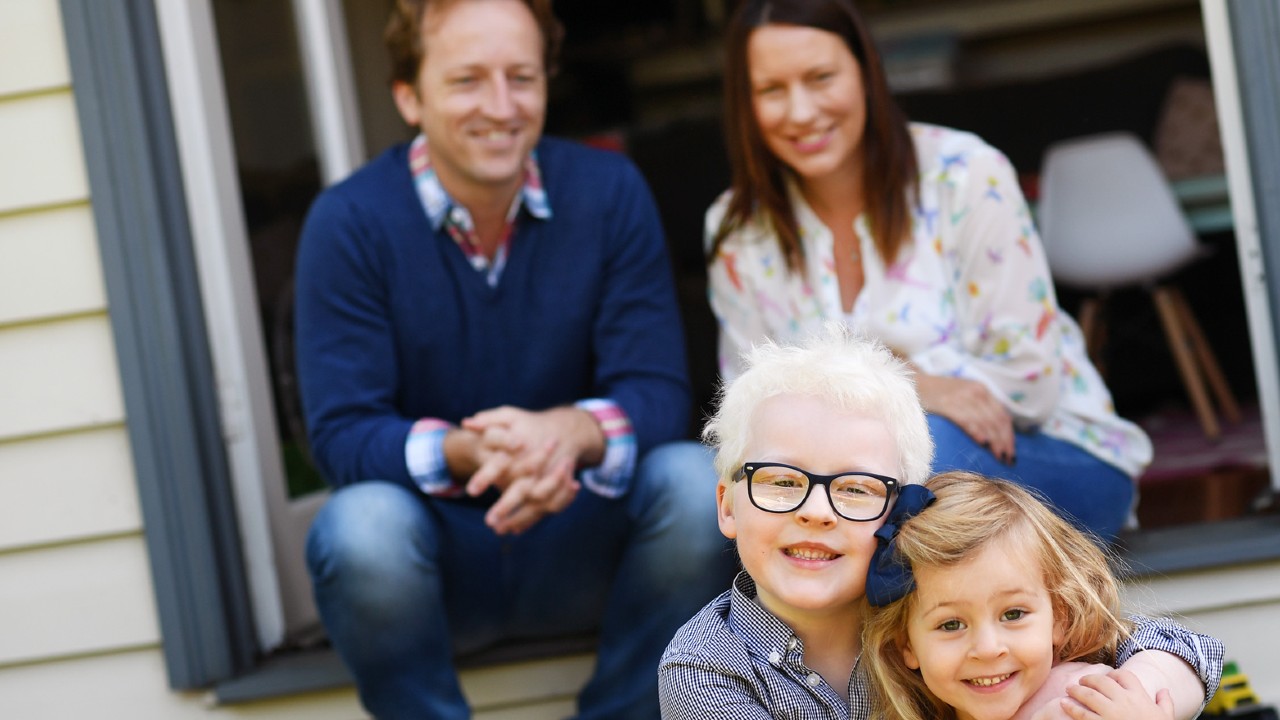 albino çocuk ve ailesi