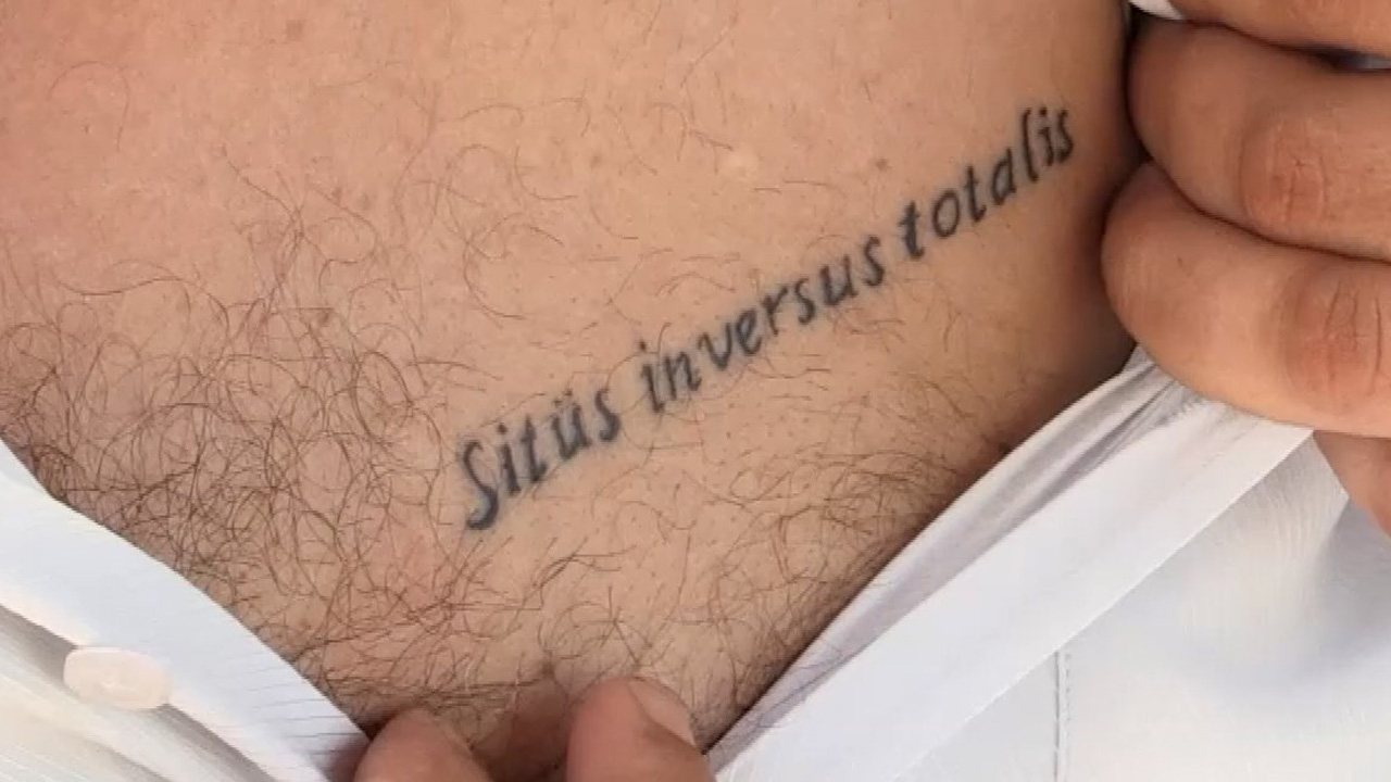 situs inversus totalis tattoo