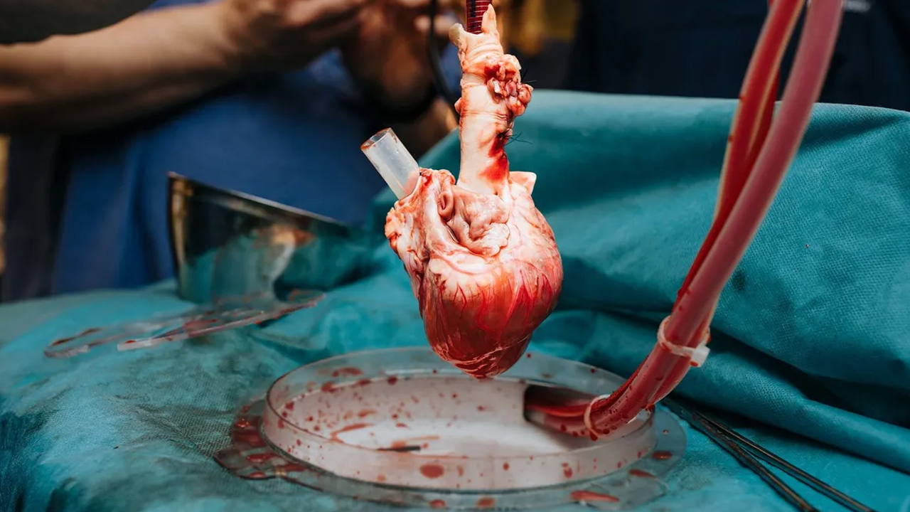 Organ Naklinde Bile Çekişme Var: Bir Kadın Kalbi, Başka Bir Erkeğin Göğsünde Atabilir mi?